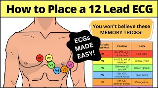 12 Lead Ecg Placement Made Easy Emt Nursing Paramedic Ecg Nursing